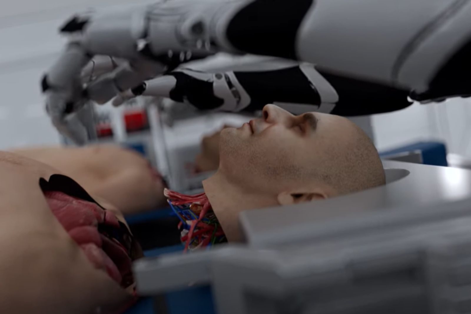 Transplantes de Cabeça Transplantes de Cabeça: revolução médica ou ficção científica?